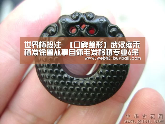 世界杯投注-【口碑整形】武汉雍禾植发徐鲁从事自体毛发移植专业6余年(图2) 世界杯投注